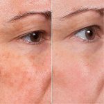 سرم ویتامین سی گارنیر حجم 30 میلی لیتر - تصویر 8