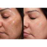 سرم ویتامین سی گارنیر حجم 30 میلی لیتر - تصویر 4