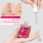 سرم نیاسینامید آنوا | ضد لک و روشن کننده اصل کره - تصویر 2