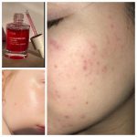 سرم نیاسینامید آنوا | ضد لک و روشن کننده اصل کره - تصویر 9