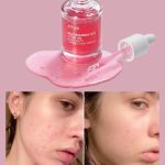 سرم نیاسینامید آنوا | ضد لک و روشن کننده اصل کره - تصویر 5