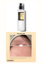 سرم اسنس حلزون کوزارکس مدل ادونس اسنیل 96 حجم 100 میل - تصویر 6