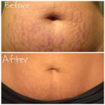 کرم ترمیم کننده لاروش پوزای سیکاپلاست بوم بی۵ پلاس - تصویر 6