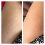 کرم ترمیم کننده لاروش پوزای سیکاپلاست بوم بی۵ پلاس - تصویر 2