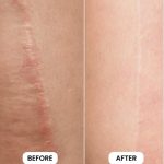 کرم ترمیم کننده لاروش پوزای سیکاپلاست بوم بی۵ پلاس - تصویر 5