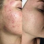 کرم ترمیم کننده لاروش پوزای سیکاپلاست بوم بی۵ پلاس - تصویر 3